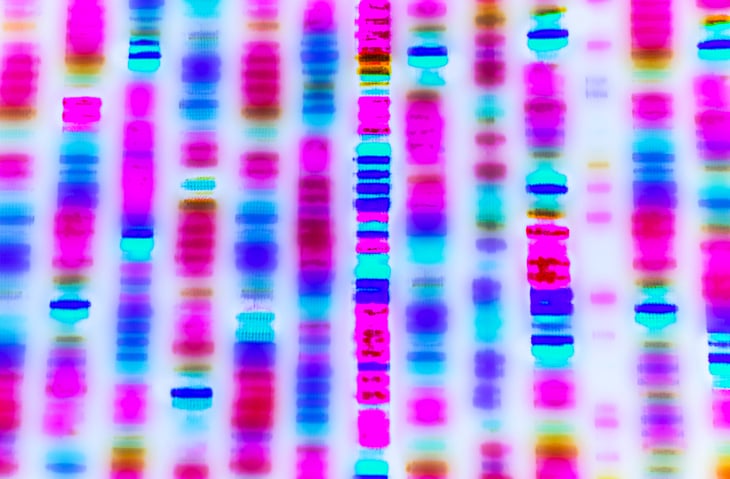 Colangiocarcinoma & LMA: Targeting IDH1 for Resistant Forms - News Directory 3