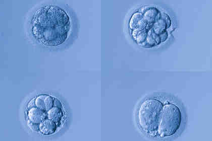 Bambino con tre genitori biologici: ecco cosa c’è di vero