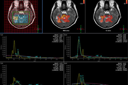 Il cervello è unico, come le impronte digitali