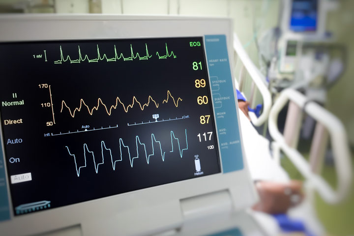 Qual è la differenza tra coma e morte cerebrale?