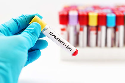 Colesterolo alto: per combatterlo bisogna spegnere la proteina PCSK9