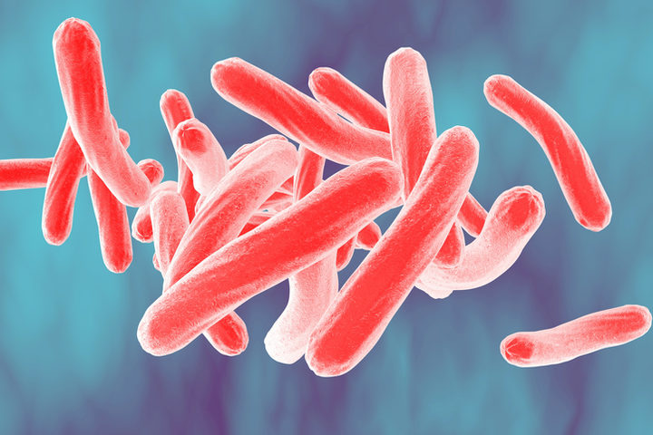 Tubercolosi: a preoccupare sono le co-infezioni con Hiv