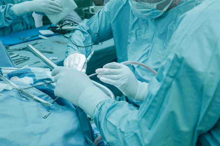 Sostituzione della valvola aortica: chirurgia «soft» anche per i pazienti a medio rischio