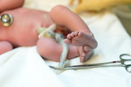 «Lotus birth»: il parto senza taglio del cordone è inutile (e dannoso)