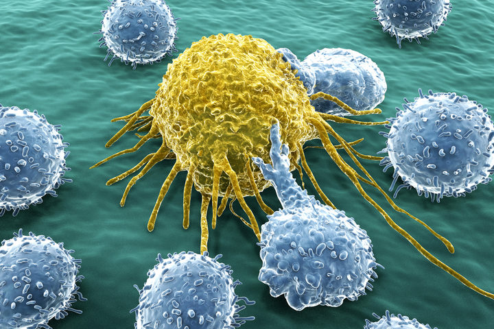 Leucemie e linfomi: nuove speranze dalla terapia genica Car-T 