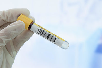 Esistono test prevaccinali per prevedere reazioni avverse?