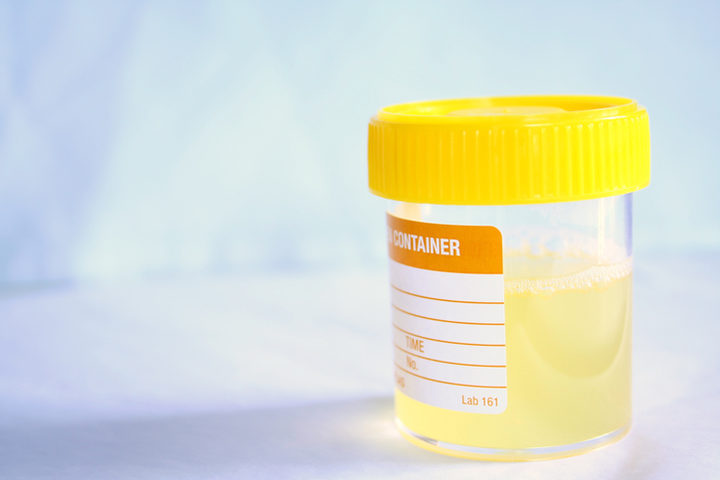 Infezioni urinarie: uso inappropriato di antibiotici in 4 casi su 10