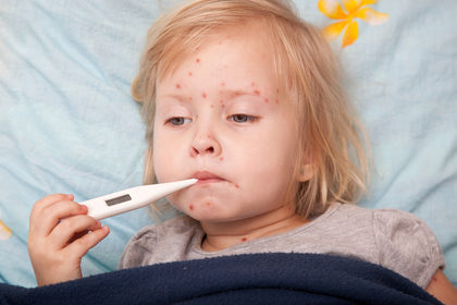 Vaccino contro la varicella: un'opportunità per grandi e bambini
