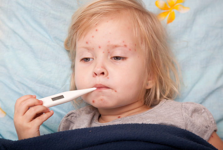 Vaccino contro la varicella: un'opportunità per grandi e bambini