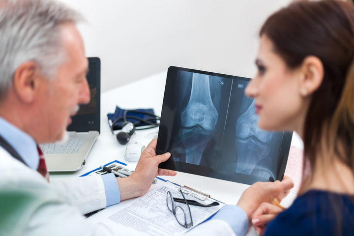 Perché con la menopausa aumenta il rischio di avere l'osteoporosi?