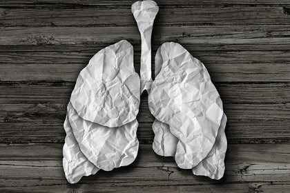 Trapianto polmone: quando l’organo arriva da un fumatore