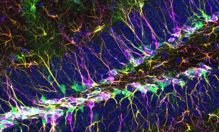 Scoperto il gene che «guida» le staminali nel cervello