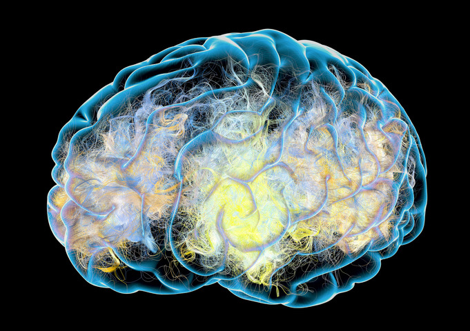  Alzheimer: la dopamina è una delle possibili cause 