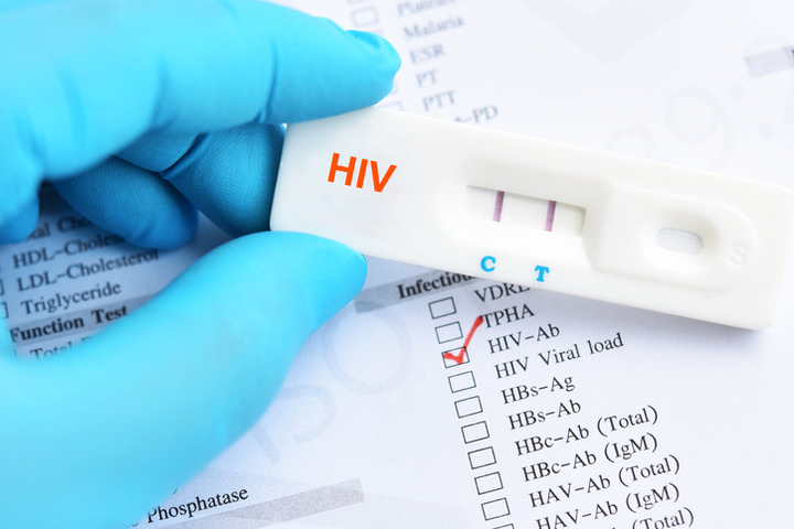 HIV: un uomo «guarisce» grazie alle cure anticancro
