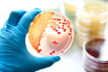 Quando gli antibiotici alterano il microbioma l'immunoterapia non funziona 