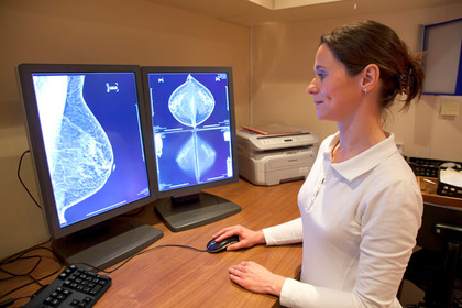 Tumore al seno: e se la mammografia sbaglia?