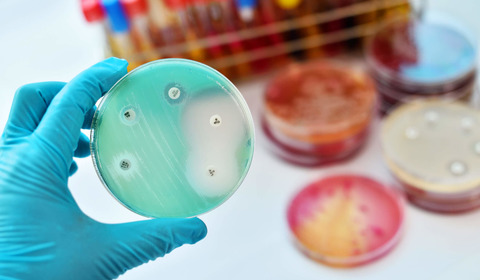 Resistenza agli antibiotici: 6 mosse per contrastarla