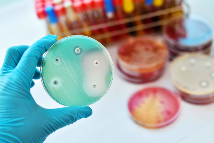 Resistenza agli antibiotici: 6 mosse per contrastarla