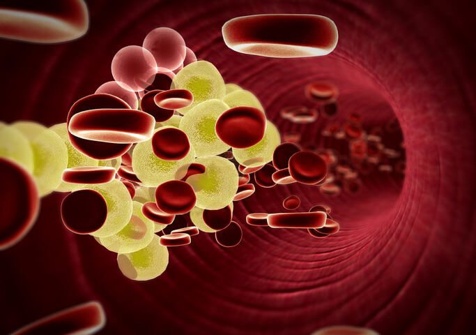 Colesterolo Ldl ancora più giù per difendere il cuore | Fondazione Umberto Veronesi
