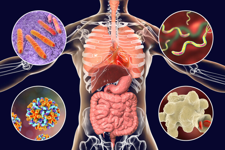 papilloma virus e tumore al colon papiloma nasal histologia