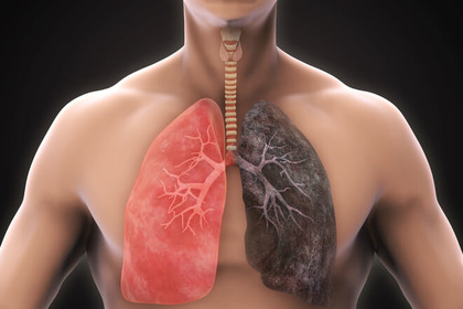 Così i polmoni si «rigenerano» dopo aver smesso di fumare