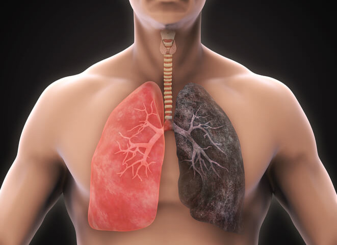 Così i polmoni si «rigenerano» dopo aver smesso di fumare