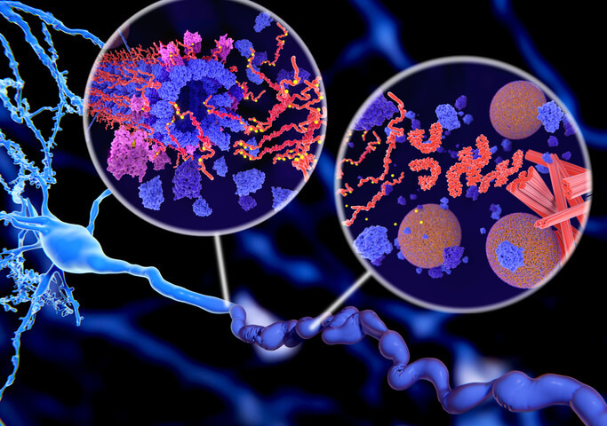 Alzheimer: studiare la proteina Tau per nuove strategie di cura