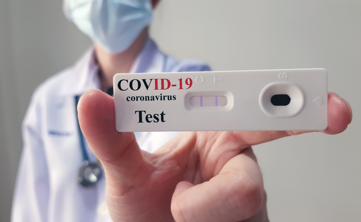 Test sierologici per coronavirus: cosa sono e a cosa servono