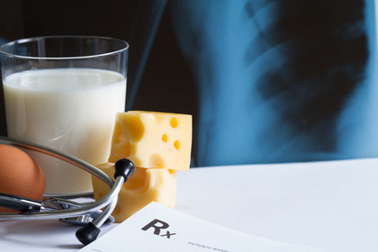 Menopausa: latte e formaggi (da soli) non proteggono le ossa