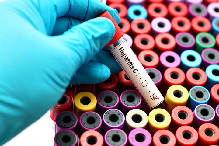 Epatite C: la scoperta che vale il premio Nobel 2020 