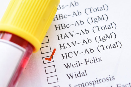 Epatite C: screening esteso per individuare gli asintomatici 