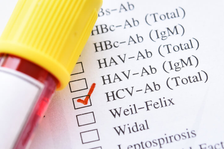 Epatite C: screening esteso per individuare gli asintomatici 