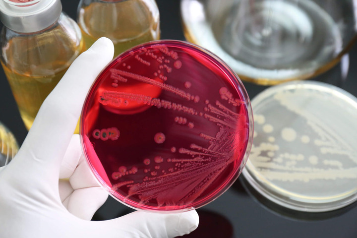 Infezioni alimentari: resistenza agli antibiotici ancora alta