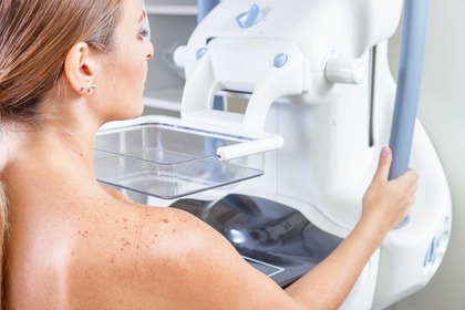 Screening mammografico: personalizzarlo in base al rischio