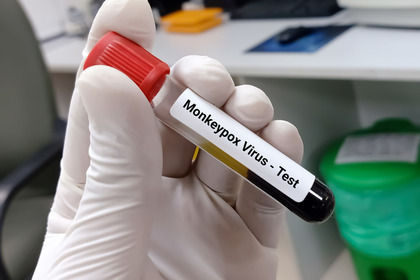 Monkeypox: casi, sintomi, contagi ed evoluzione