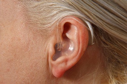 Quali sono gli effetti della chemioterapia sull'udito?