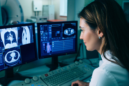 Tumore del polmone a piccole cellule: l'immunoterapia funziona
