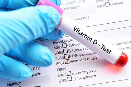 Immunoterapia: più efficace con la vitamina D?