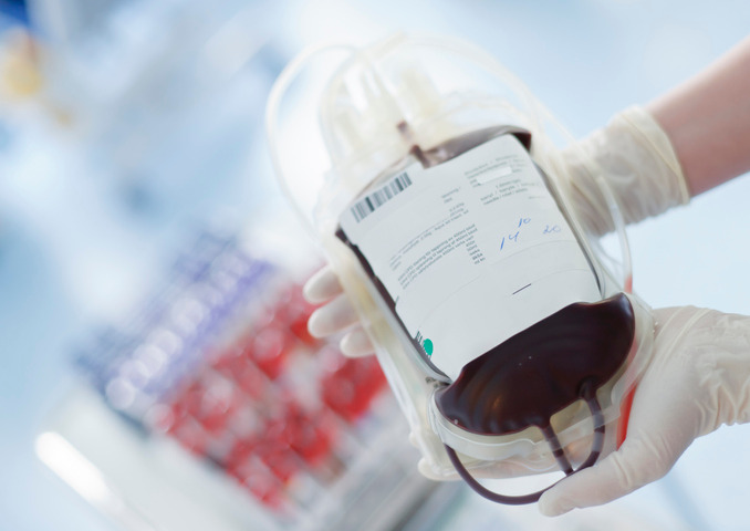 BE Car7-T: una nuova cura per la leucemia linfoblastica acuta?