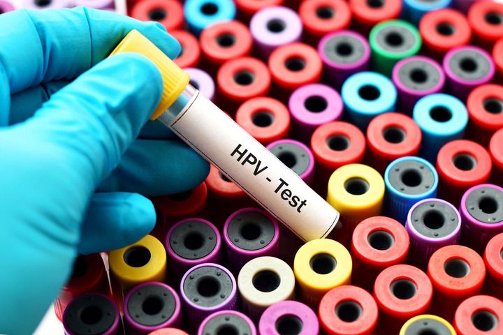 HPV: la negativizzazione spontanea è possibile?