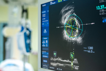 Long-Covid: il danno al cuore è una questione "autoimmune"