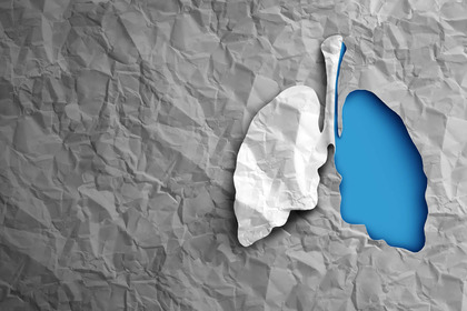 Tumore al polmone: perché si fanno pochi screening? 