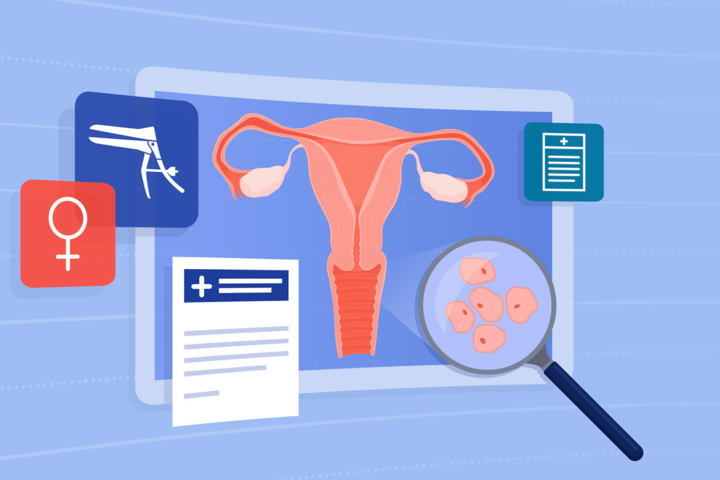 Pap test: le sigle sul referto 