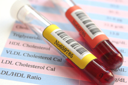 Abbassare il colesterolo con l'editing epigenetico?