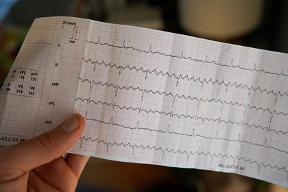 I 9 nemici di chi ha la fibrillazione atriale