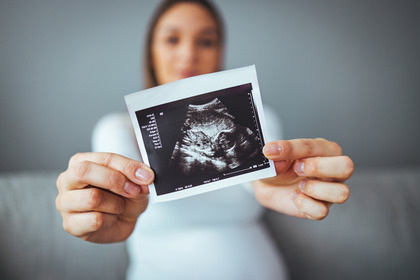 Gravidanza sicura, anche dopo un tumore al seno BRCA