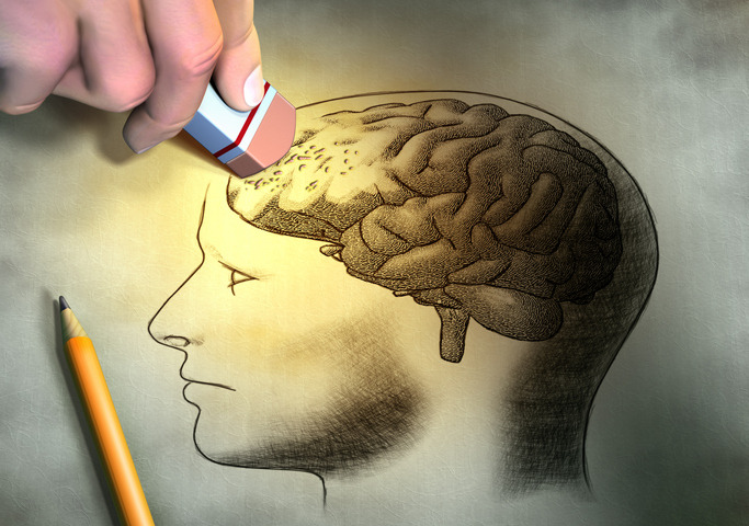 Alzheimer, quanto conta la genetica? Tra DNA e nuovi farmaci