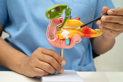 Tumore del pancreas: una svolta per i casi operabili