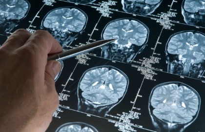 L’ossitocina rafforza la socialità (come la marijuana)