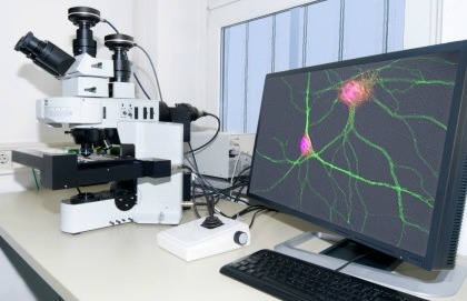 Anche nel cervello c'è il sistema immunitario